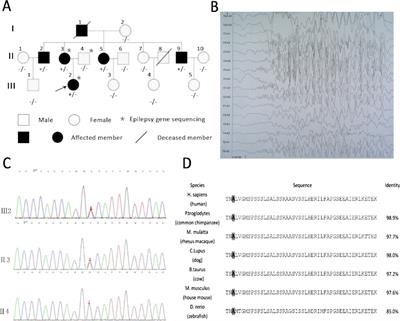 A Rare KIF1A Missense Mutation Enhances Synaptic Function and Increases Seizure Activity